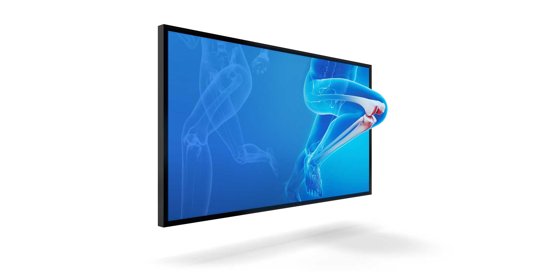 3d-global-gmbh-3d-medical-screen-x-ray